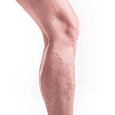 Jambes Lourdes